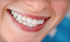 Xtreme Teeth Whitening LLC Coupons Monroeville, Pennsylvania Deals