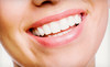 Apple Dental Coupons Warren, Michigan Deals