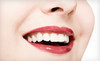 Javadi Smiles Coupons La Mesa, California Deals