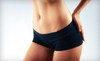 Timeless Laser Rejuvenation Center Coupons Kissimmee, Florida Deals
