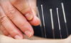 Rostberg Chiropractic & Acupuncture Coupons Prairie Village, Kansas Deals