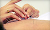 Adina Robinson Acupuncture Coupons El Dorado, California Deals