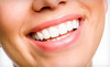 Center For Dentistry Coupons Naperville, Illinois Deals
