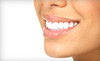 Mollner Dentistry Coupons Denver, Colorado Deals