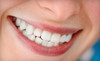 Baker Cosmetic & Family Dentistry Coupons Clearwater, Florida Deals