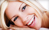 Bella Teeth by Nicole Coupons Buffalo, New York Deals