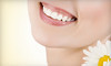 Glo My Teeth Coupons West Hollywood, California Deals
