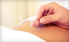 Abundant Health Acupuncture, LLC Coupons Madison, Wisconsin Deals