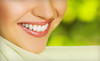 OC Dental Center Coupons Santa Ana, California Deals