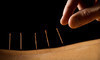 AJ Acupuncture Clinic Coupons Fulton, Maryland Deals