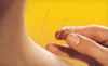 HealthPro Chiropractic & Acupuncture Coupons Houston, Texas Deals