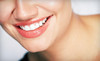 Crown Heights Dentistry Coupons Oklahoma City, Oklahoma Deals