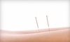 Acupuncture Wellness Coupons Birmingham, Michigan Deals
