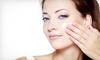 Skin Treatment & Acne Center Coupons Felton, California Deals