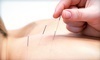 Angie's Acupuncture Coupons Seymour, Tennessee Deals