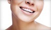 Chandler Cosmetic & Implant Dentistry Coupons Chandler, Arizona Deals