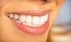 Coral Ridge Smile Coupons Fort Lauderdale, Florida Deals