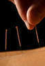 Acupuncture INC Coupons Naperville, IL Deals