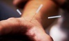 Tucson Community Acupuncture Coupons Tucson, Arizona Deals