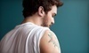 Lasercare Tattoo Removal Coupons Eagle River, Alaska Deals